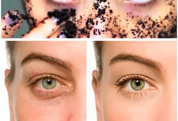 Cómo atenuar ojeras y descongestionar utilizando Café